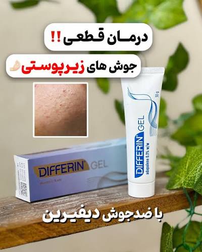 ژل دیفرین آداپالن-قوی‌ترین درمان جوش و جوش زیرپوستی و منافذ باز