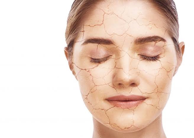 تفاوت پوست خشک و دهیدراته چیست؟ بهترین روتین آبرسانی و درمان خشکی پوست درتا سنتر